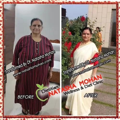 Best Dietitian in Gurgaon 39 weight loss by homemade food