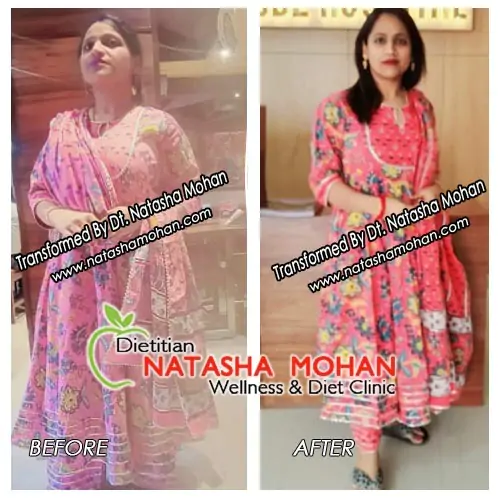 Best Dietitian in Gurgaon 43 weight loss by homemade food